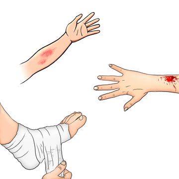 first aid injuries illustration
