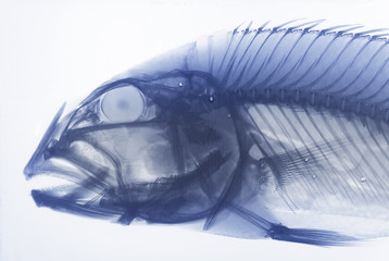Xray Of A Fish