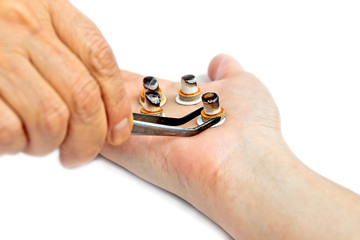 Acupuncture treatment