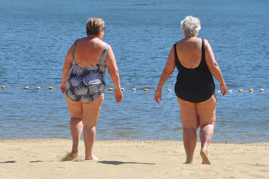 cellulite