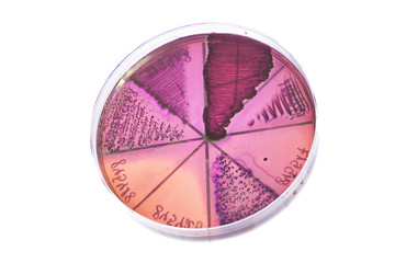 Bacteria on petri dish