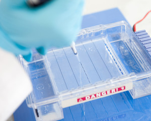 loading a sample into a gel for electrophoresis