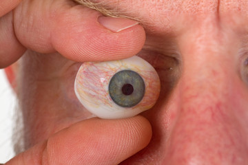Augenprothese