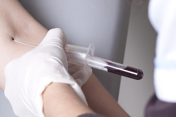Drawing blood procedure