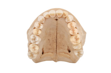 upper jawbone