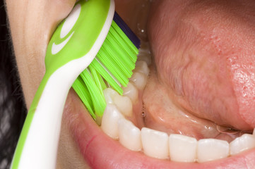 Mundhygiene
