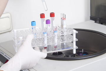 Hands loads blood samples in centrifuge