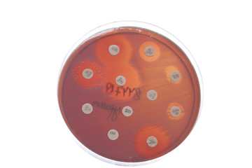 Bacteria on petri dish