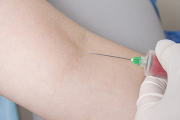 Drawing blood procedure