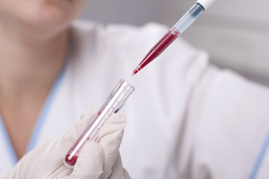 Micro Pipette With Blood