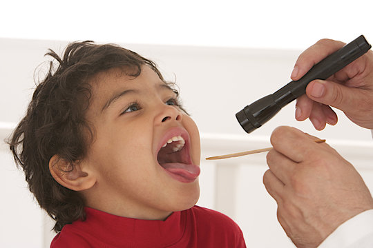 Enfant - Inflammation des  Amygdales