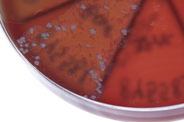 Bacteria on petri dish