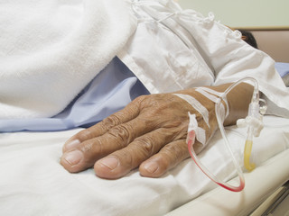 IV in Arm