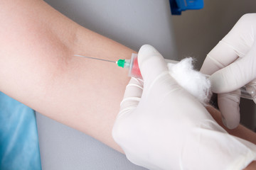 Drawing blood procedure