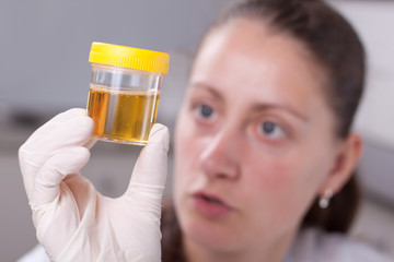 Fototapeta premium Woman examine urine container