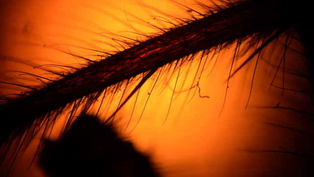 virus and bacteria from a microscope