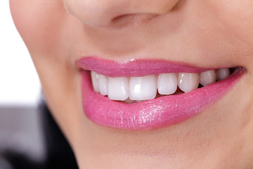 Woman teeth