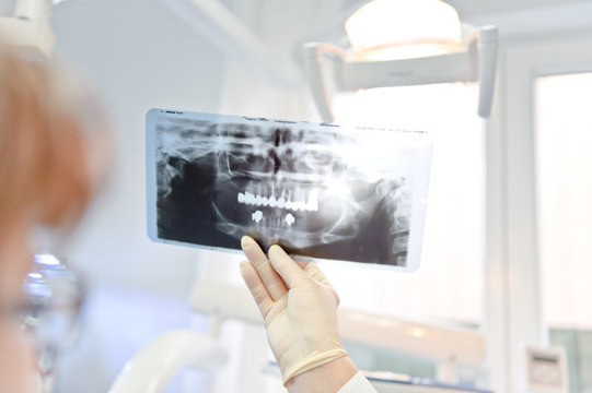 Zahnärztin zeigt Röntgenbild