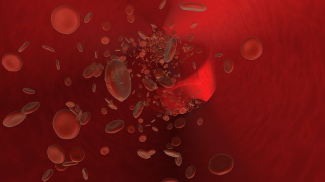Hypodermic syringe injects substance into an artery.