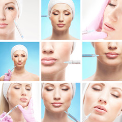 A collage of images with young woman on a botox procedure