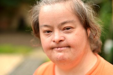 Person with down syndrome