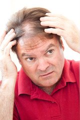 Man Worried About Balding