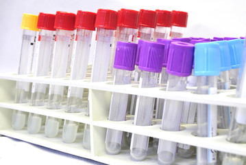 laboratorio analisis