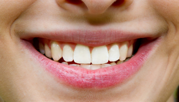 Strahlendes Lachen