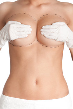 Breast plastic correction, isolated, white background