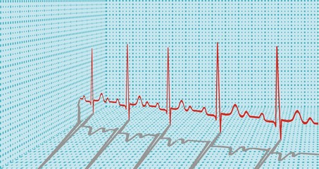 ECG in form 3d with shadows. Vector illustration.