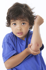 Enfant - Petit bobo du coude