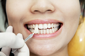 Naklejka premium Examining teeth