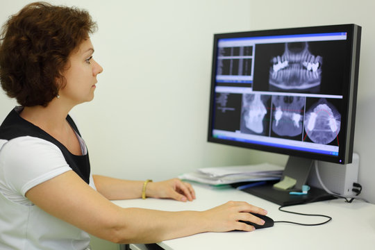 Dentist carefully looks jaw X-rays at computer monitor