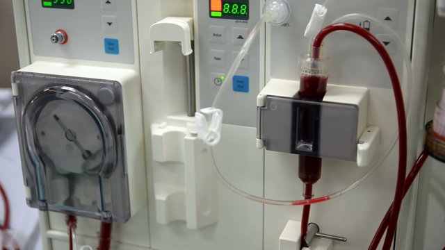 Arlificial kidney (dialysis) medical device with rotating pumps