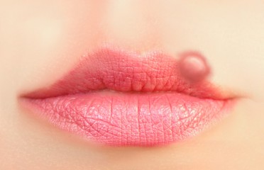 Close up of lips affected by herpes (cold sore) - obrazy, fototapety, plakaty