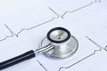 stethoscope on a cardiogram