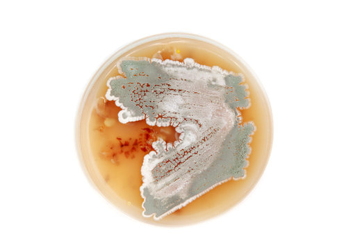 Streptomyces on agar plate