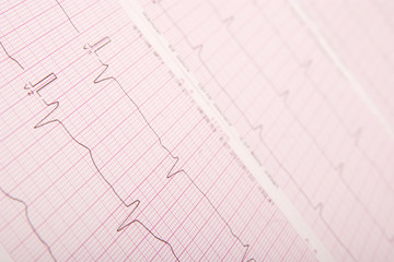 Naklejka premium ECG chart