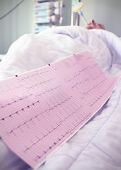 cardiogram at the bedside. medical concept