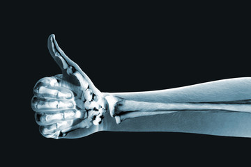 dramatized x ray of a hand thumbs up - obrazy, fototapety, plakaty