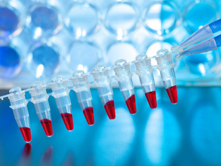 DNA paternity