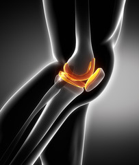 Meniscus and knee cartilage anatomy - obrazy, fototapety, plakaty