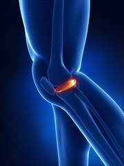 Knee meniscus anatomy lateral view - obrazy, fototapety, plakaty