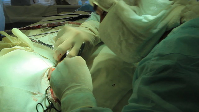 Operation. Surgical table. implantation