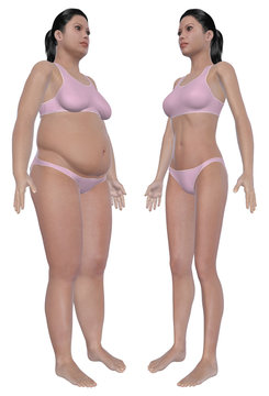 Weight Loss Before And After Angled Front View