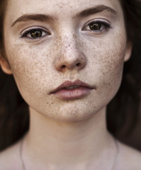 Portrait of woman with freckles