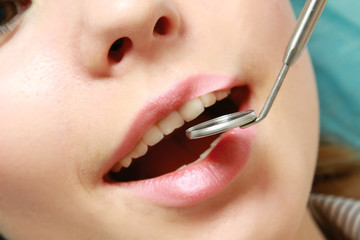 Teeth treatment, close-up of a patient