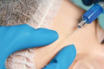 An injection of a botox to a woman's face, close-up