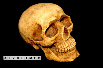 Totenkopf und Alzheimer