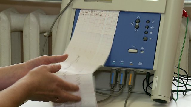 Heartbeat Fetal Monitoring)